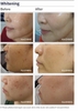 Nước hoa hồng (nước thần) LK ROP Arbutin2% Vita Harmony Essence Toner 200ml