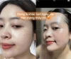 Kem đặc trị nám, phân giải sắc tố Meline 02 Caucasian Skin Night