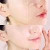 Tinh Chất Phục Hồi, Dưỡng Ẩm, Tái Tạo, Sáng Da LaRoche-Posay Hyalu B5 Serum 30ml