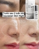 Kem đặc trị nám, phân giải sắc tố Meline 02 Caucasian Skin Night