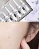 Tinh Chất Hủy Nám, Tàn Nhang, Thâm Mụn, Sáng Da CNP Rx Skin Revive Demeline Ampoule