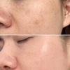 Tinh Chất Làm Mờ Đốm Nâu, Mờ Thâm Ná.m Murad Rapid Dark Spot Correcting Serum 30ml