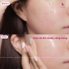 Tinh Chất Phục Hồi, Cấp Ẩm Da EPI-RX B5.5 Advanced Repairing Gel 30ml