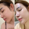 Serum Kiềm Dầu, Thu Nhỏ Lỗ Chân Lông TIA'M Pore Minimizing 21 Niacinamide 20% + Zinc 1% 40ml