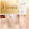 Gel Tẩy Da Chết Dưỡng Ẩm Và Làm Sáng Da Edally EX Smoothing Peeling Gel Hàn Quốc