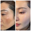 Tinh Chất Hủy Nám, Tàn Nhang, Thâm Mụn, Sáng Da CNP Rx Skin Revive Demeline Ampoule