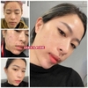 Tinh Chất Lumos Acne Hỗ Trợ Giảm Mụn, Giảm Dầu Nhờn (có hóa đơn VAT)