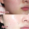 Siêu Tinh Chất Sáng Da, Giảm Thâm Nám Angel's Liquid Tranexamic Mela Zero Ampoule 30ml