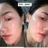 Tinh Chất Peel da, tái tạo da, giảm nếp nhăn sạm da NeoStrata ProSystem Retinol 1,5 ml