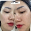 Tinh Chất Peel da, tái tạo da, giảm nếp nhăn sạm da NeoStrata ProSystem Retinol 1,5 ml