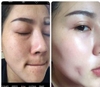 Kem dưỡng ban ngày white angel skinnaz ( dưỡng trắng nâng tông k bết dính)