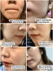 Tinh Chất Peel da, tái tạo da, giảm nếp nhăn sạm da NeoStrata ProSystem Retinol 1,5 ml