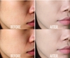 Bộ 5sp dưỡng trắng da Zo Skin Brightening Program (hàng xách tay - date 2024)