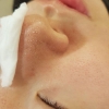 Ủ Mũi Xử Lý Mụn Removes Blackheads 50ml