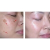 Tinh Chất Dưỡng Sáng, Mờ Nám Và Phục Hồi Da Ban Đêm Casmara Lightening Clarifying Concentrated Serum 30ml (Hàng Công Ty)