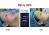 Mặt Nạ Phục Hồi Cấp Ẩm, Giảm Kích Ứng Cao Cấp Smas Peptide Silk Mask ( Cam kết hàng AUTH )