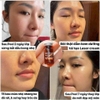 Tinh Chất Peel da, tái tạo da, giảm nếp nhăn sạm da NeoStrata ProSystem Retinol 1,5 ml