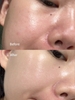 Tinh Chất Dưỡng Sáng Da, Mờ Thâm Nám oh!oh! Daily Nia23 Advanced Correcting Serum 30ml