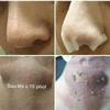 Dung Dịch Ủ Mụn, Sạch Sâu Mụn Đầu Đen & Se Khít Lỗ Chân Lông Medi-Peel Extra Super 9 Blackhead Care Solution 50ml