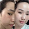 Tinh Chất Retinol Phục Hồi ,Tái Tạo, Giảm Thâm Nám Và Dưỡng Sáng Đều Màu Da Ruée MILA Serum Retinol
