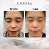Kem Dưỡng ẩm, phục hồi ,chống lão hóa và bảo vệ da chuyên sâu Casmara Age Defense Cream 360 50ml