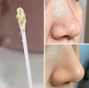 Dung Dịch Ủ Mụn, Sạch Sâu Mụn Đầu Đen & Se Khít Lỗ Chân Lông Medi-Peel Extra Super 9 Blackhead Care Solution 50ml