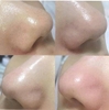 Dung Dịch Ủ Mụn, Sạch Sâu Mụn Đầu Đen & Se Khít Lỗ Chân Lông Medi-Peel Extra Super 9 Blackhead Care Solution 50ml