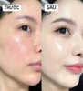 Kem Nền Make Up For Ever HD Skin Hydra Glow Hydrating Foundation Tone 1R00 30ml