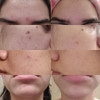 Serum huyết thanh dưỡng trắng da, mờ thâm, chống lão hoá ECOS Arbutin 5% Hypoallergenic Whitening Serum