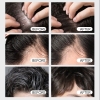 Dầu gội giảm gàu, nấm cho tóc dầu Vichy Dercos Technique Anti-Dandruff Shampoo 390ml