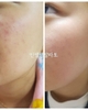 Sữa rửa mặt dạng bột ngừa mụn ẩn, bã nhờn, thu nhỏ lỗ chân lông Active Clean-up Powder Incellderm 