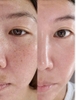 Bút Xóa Nám Dưỡng Trắng Da Differ&Deeper C Toning Daily Shot (Hộp 2 ống 2.5ml)