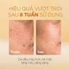 Tinh Chất Dưỡng Sáng Da, Mờ Thâm Nám oh!oh! Daily Nia23 Advanced Correcting Serum 30ml