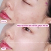 Tinh Chất Phục Hồi, Cấp Ẩm Da EPI-RX B5.5 Advanced Repairing Gel 30ml
