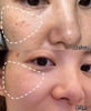 Tinh Chất Dưỡng Sáng, Mờ Nám Và Phục Hồi Da Ban Đêm Casmara Lightening Clarifying Concentrated Serum 30ml (Hàng Công Ty)