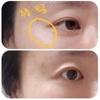 Mặt nạ dưỡng trắng, chống lão hóa Derm-All Matrix Mask 35g ( có VAT )