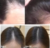 Xịt Dưỡng Tóc Và Da Đầu Hương Thảo AROMATICA Rosemary Root Enhancer 100ml