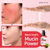 Bộ Dưỡng Phục Hồi, Tái Tạo Da Ốc Sên Some By mi Snail Truecica Miracle Repair Starter Kit