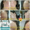 Tinh chất trắng da, trị nám, tàn nhang Dr. Gene Vita Pepta C Pi.Gene (Vitamin C)