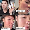 Tinh Chất Phục Hồi, Cấp Ẩm Da EPI-RX B5.5 Advanced Repairing Gel 30ml