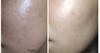 Paula’s Choice BHA 2% dung dịch hỗ trợ cải thiện mụn, sáng da 30ml