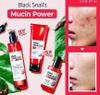 Bộ Dưỡng Phục Hồi, Tái Tạo Da Ốc Sên Some By mi Snail Truecica Miracle Repair Starter Kit