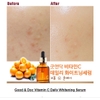 Serum dưỡng sáng mờ thâm nám Goodndoc Vitamin C-16.5 Daily Whitening Serum 30ml