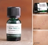 Tinh dầu tràm trà trị mụn và kháng khuẩn Tea Tree Oil The Body Shop