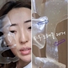 Mặt nạ dưỡng trắng, chống lão hóa Derm-All Matrix Mask 35g ( có VAT )