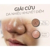 Peel làm sạch sâu, loại bỏ mụn cám đầu đen, căng bóng bằng thảo dược Christina BioPhyto 4A Herbal Peel 250ml