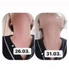 Kem Dưỡng Chống Lão Hóa Chuyên Sâu Cho Vùng Da Cổ Medi-Peel Naite Thread Neck Cream 100ml (có VAT)