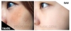 Kem Dưỡng Trắng Da Mờ Thâm Mụn, Nám, Tàn Nhang Fixderma Skarfix-TX Cream 15gr