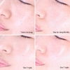 Bộ Dưỡng Phục Hồi, Tái Tạo Da Ốc Sên Some By mi Snail Truecica Miracle Repair Starter Kit