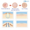 Miếng dán hút cồi mụn siêu mỏng, chống thấm nước Dr Wonder Anti Spot Patch - 72 miếng